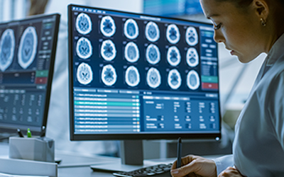 導入ケーススタディ: UCB社